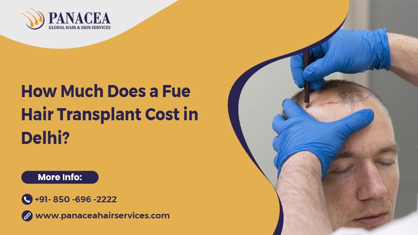 Fue Hair Transplant Cost in Delhi